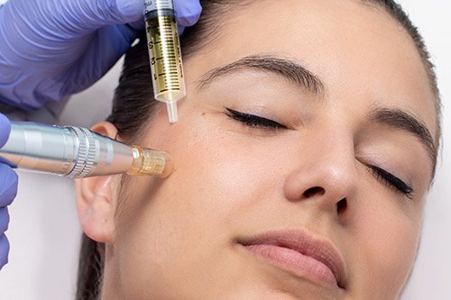 Dermapen/ microneedling  1 session